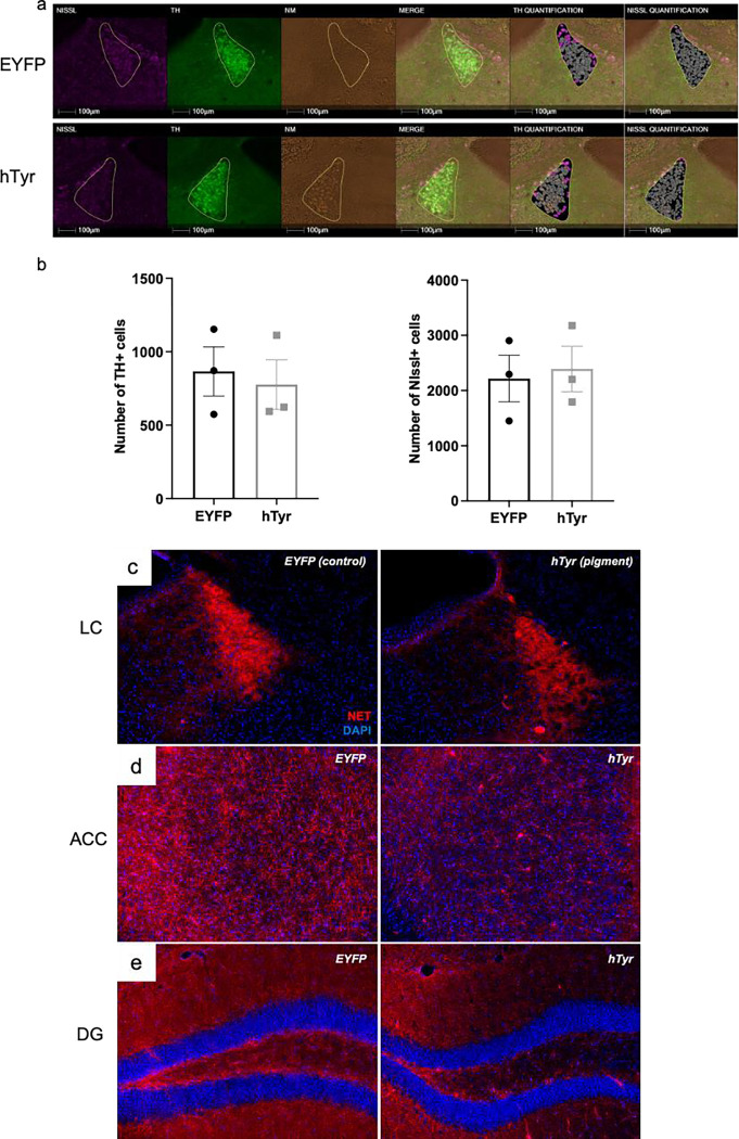 Tyrosinase-induced neuromelanin accumulation triggers rapid dysregulation and degeneration of the mouse locus coeruleus.