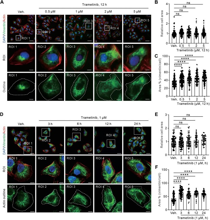 Discovery of Trametinib as an orchestrator for cytoskeletal vimentin remodeling.