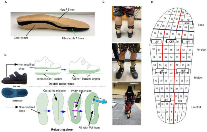 Comparative Analysis of Three Types of Therapeutic Offloading Diabetic Shoes With Custom Made Insole on Plantar Pressure Distribution in Severe Diabetic Charcot Foot.