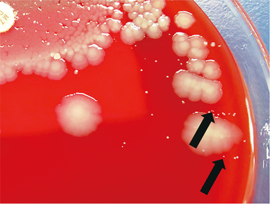 Decubitus ulcer infection and bacteremia due to tazobactam/piperacillin-resistant <i>Veillonella parvula</i>.