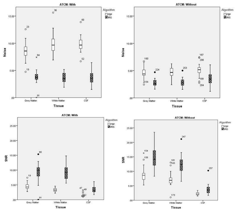 Performance of Iterative Reconstruction in Image Space Algorithm in Combination with Automatic Tube Current Modulation Compared to Filtered Back Projection in Brain CT Scan.