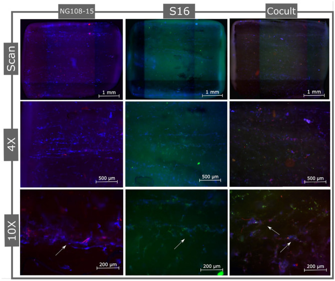 Dynamic three-dimensional coculture model: The future of tissue engineering applied to the peripheral nervous system.