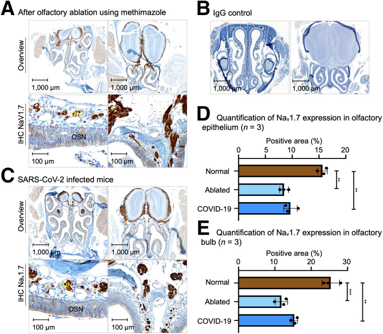 Noninvasive Diagnostic Method to Objectively Measure Olfaction and Diagnose Smell Disorders by a Molecularly Targeted Fluorescence Imaging Agent.
