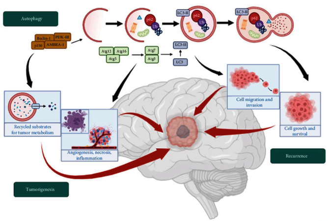 Immunohistochemical Profile of p62/SQSTM1/Sequestosome-1 in Human Low- and High-Grade Intracranial Meningiomas.