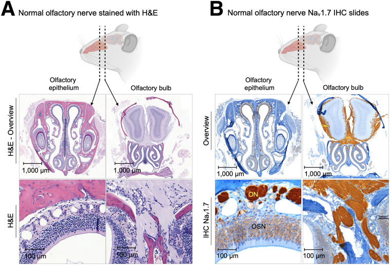 Noninvasive Diagnostic Method to Objectively Measure Olfaction and Diagnose Smell Disorders by a Molecularly Targeted Fluorescence Imaging Agent.