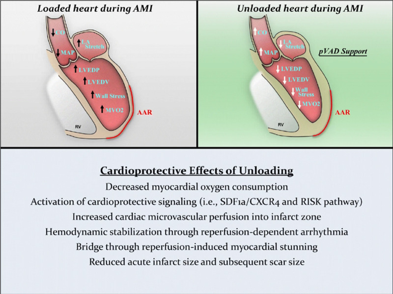 Management of Myocardial Infarction: Emerging Paradigms for the Future.
