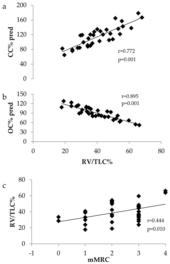 Small Airways Dysfunction and Lung Hyperinflation in Long COVID-19 Patients as Potential Mechanisms of Persistent Dyspnoea.