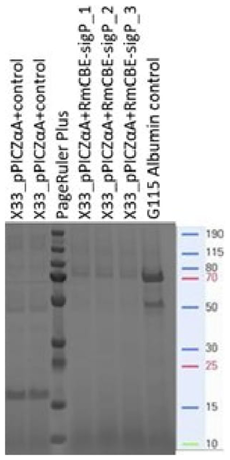 Cloning, recombinant expression, and characterization of a <i>Rhipicephalus microplus</i> carboxylesterase.