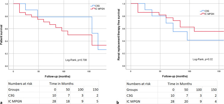 Membranoproliferative Glomerulonephritis over 20 Years at a Tertiary Referral Center in the UK.