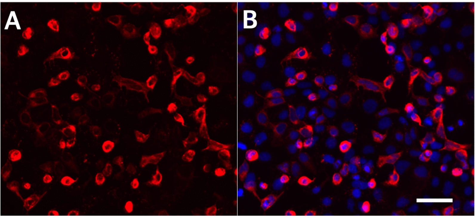 Ectopically expressed rhodopsin is not sensitive to X-rays.