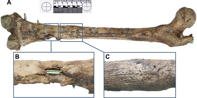 Combining anthropology and imaging to reconstruct antemortem trauma for identification purposes.