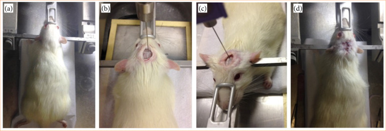 Ultrasonic neuromodulation as a new therapy for spasticity in an animal model of spastic cerebral palsy.