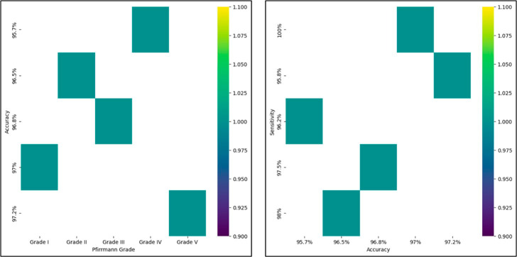 Artificial Intelligence Classification for Detecting and Grading Lumbar Intervertebral Disc Degeneration.