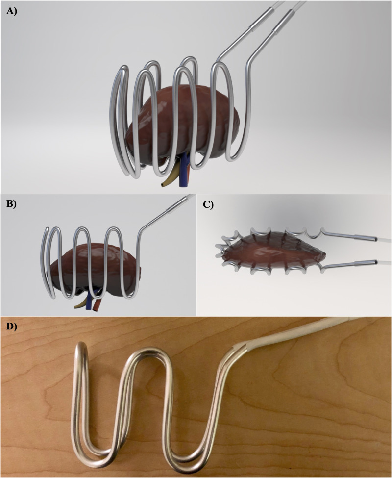 A Novel Cooling Device for Kidney Transplant Surgery.