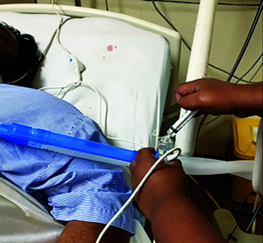 Polymyxin B Plus Aerosolized Colistin vs Polymyxin B Alone in Hospital-acquired Pneumonia ("AEROCOL" Study): A Feasibility Study.