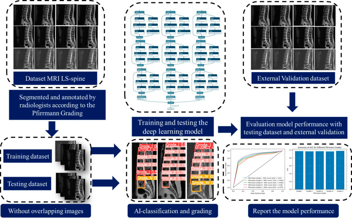 Artificial Intelligence Classification for Detecting and Grading Lumbar Intervertebral Disc Degeneration.