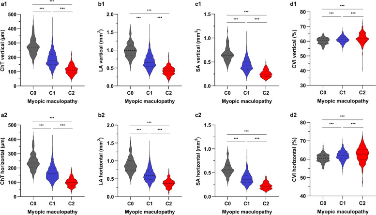 Choroidal vascular changes in early-stage myopic maculopathy from deep learning choroidal analysis: a hospital-based SS-OCT study.