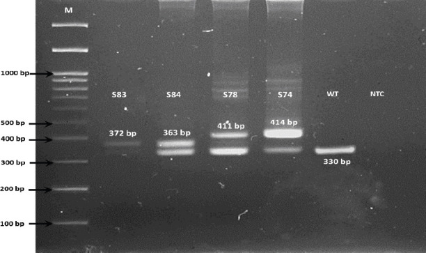 The Role of FLT3-ITD Mutation, PI3K/AKT Pathway, and Leukemia Stem Cells in D3A7 Induction therapy - the Outcomes of Adult Indonesian Patients with Acute Myeloid Leukemia.