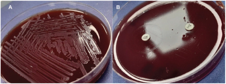Beyond the Ordinary: Paeniclostridium sordellii Osteomyelitis in a Young Male Patient From Pakistan.