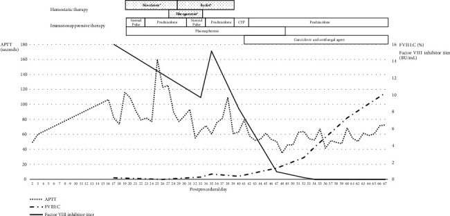 Acquired Hemophilia A Diagnosed Based on Gross Hematuria: A Case Report and Literature Review.