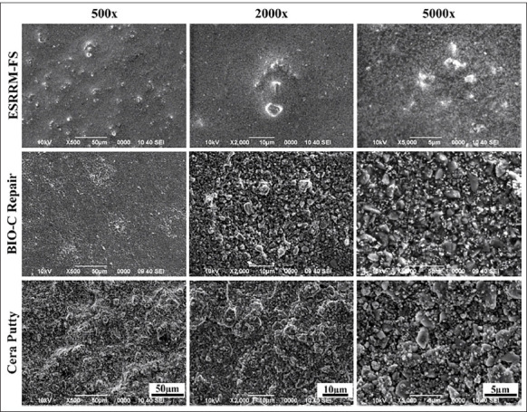 Examining the Physicochemical Composition of Three Bioceramic Putties for Endodontic Use.