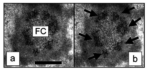 To the ring-shaped nucleolus seen by microscopy using human lymphocytes of blood donors and chronic lymphocytic leukemia patients.