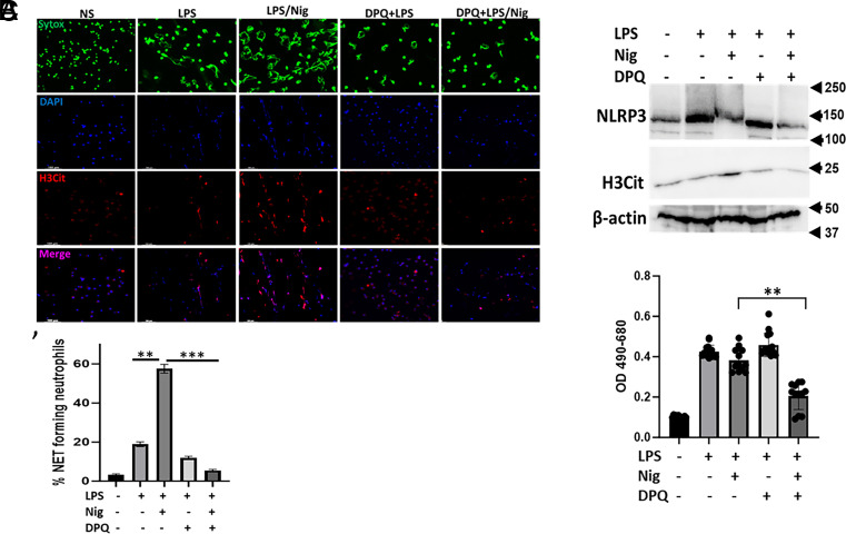 Poly(ADP-Ribose) Polymerase-1 Regulates Pyroptosis Independent Function of NLRP3 Inflammasome in Neutrophil Extracellular Trap Formation.