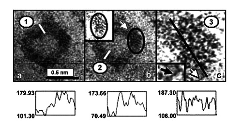 To the ring-shaped nucleolus seen by microscopy using human lymphocytes of blood donors and chronic lymphocytic leukemia patients.