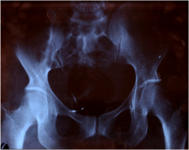 Abstract Image
