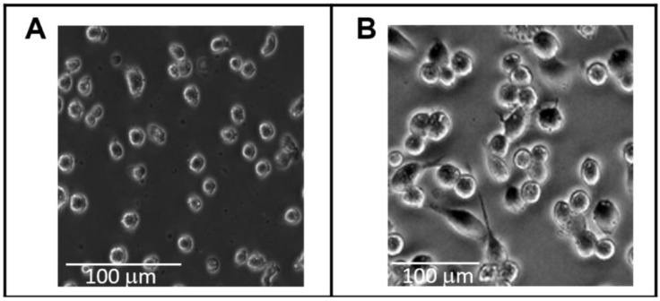 Signalling Pathways of Inflammation and Cancer in Human Mononuclear Cells: Effect of Nanoparticle Air Pollutants.