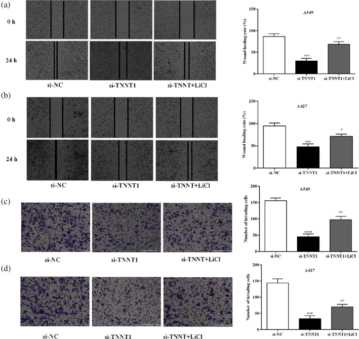 TNNT1 accelerates migration, invasion and EMT progression in lung cancer cells.
