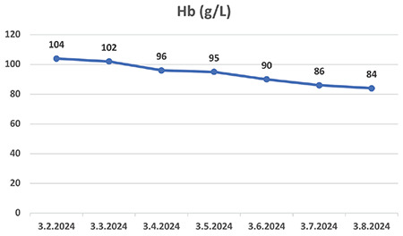 Epstein-Barr Virus-Induced Warm Autoimmune Hemolytic Anemia