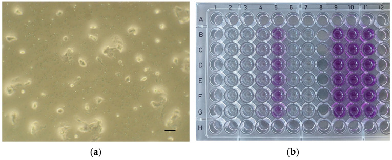 Evaluation of Cytotoxicity of the Dental Materials TheraCal LC, TheraCal PT, ApaCal ART and Biodentine Used in Vital Pulp Therapy: In Vitro Study.