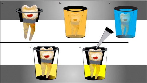 Effect of Disinfection Protocols on Bacterial Reduction in Mandibular Molars.