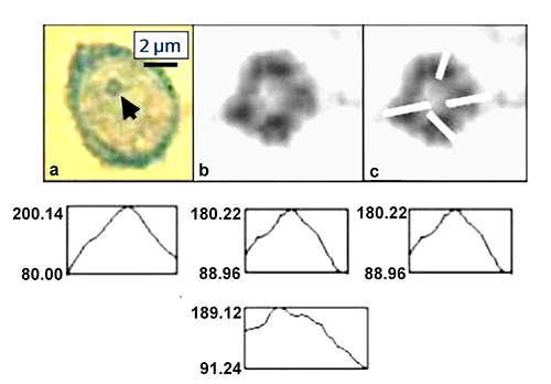 To the ring-shaped nucleolus seen by microscopy using human lymphocytes of blood donors and chronic lymphocytic leukemia patients.