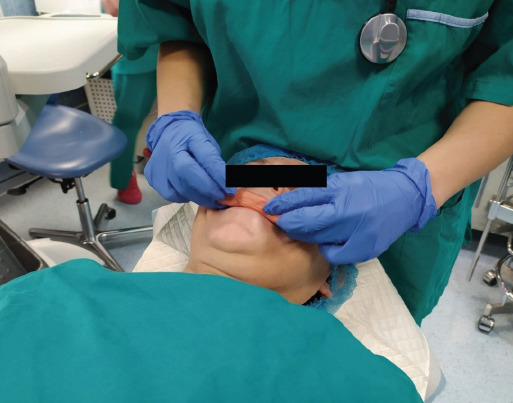 Prevention of Oral Injuries during Endotracheal Intubation: Patients' and Anesthesiologists' Perspective.