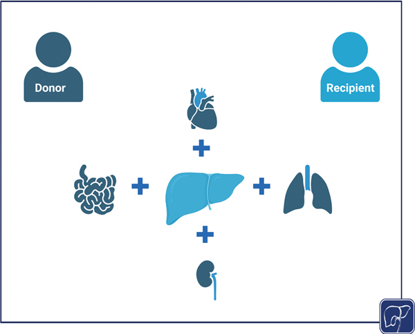 Combined Organ Transplantation in Patients with Advanced Liver Disease.