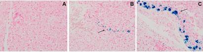Iron and vitamin D intake on a diet are able to modify the in vitro immune response to Mycobacterium leprae.