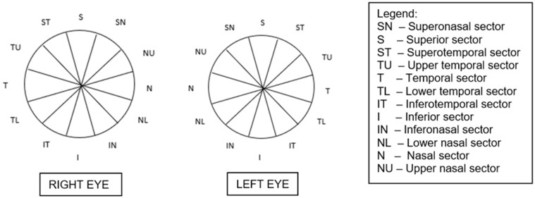 Correlation of Macular Ganglion Cell Layer + Inner Plexiform Layer (GCL + IPL) and Circumpapillary Retinal Nerve Fiber Layer (cRNFL) Thickness in Glaucoma Suspects and Glaucomatous Eyes.