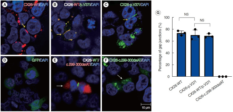 Deficient Gap Junction Coupling in Two Common Hearing Loss-Related Variants of GJB2.