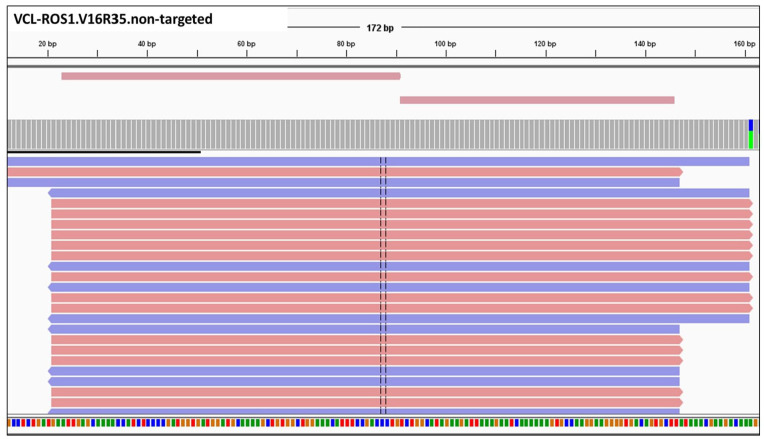 <i>VCL::ROS1</i>: A Novel ROS1 Oncogenic Fusion Detected on Next Generation Sequencing.