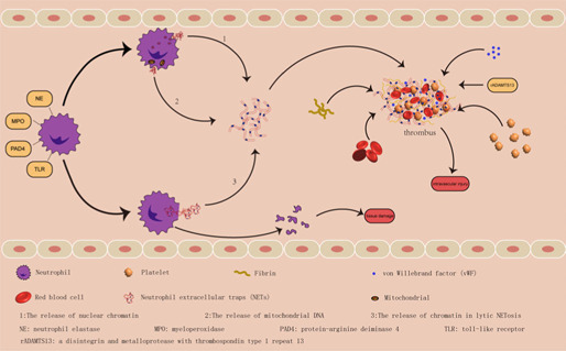 Neutrophil extracellular traps mediate neuro-immunothrombosis.