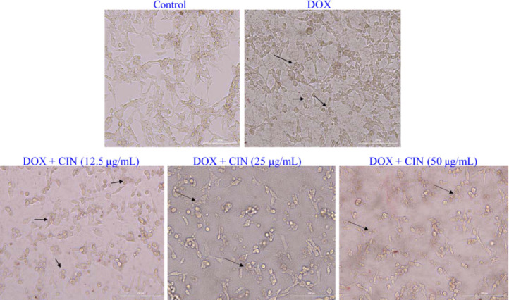 Cinnamaldehyde potentiates cytotoxic and apoptogenic effects of doxorubicin in prostate cancer cell line.