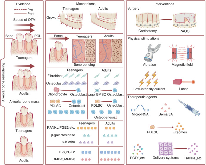 Age-related alveolar bone maladaptation in adult orthodontics: finding new ways out.