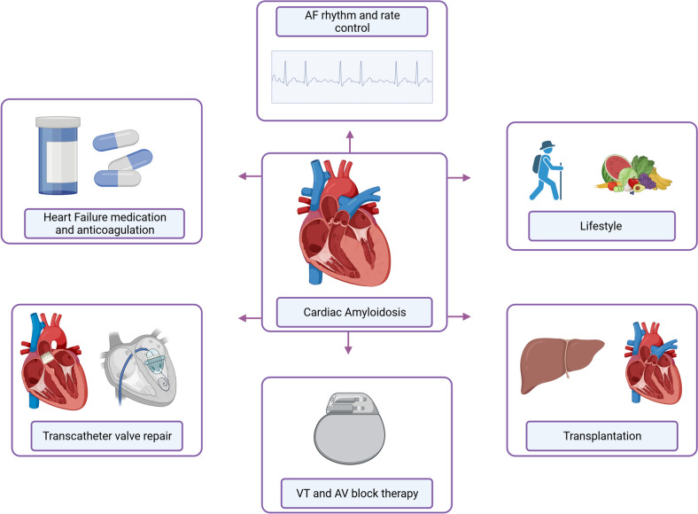 Current Therapies and Future Horizons in Cardiac Amyloidosis Treatment.