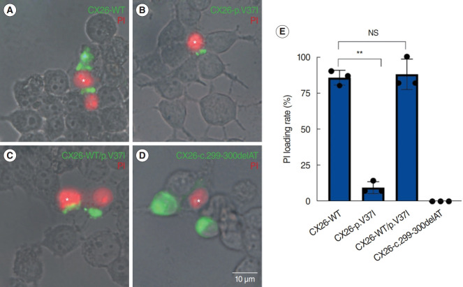 Deficient Gap Junction Coupling in Two Common Hearing Loss-Related Variants of GJB2.
