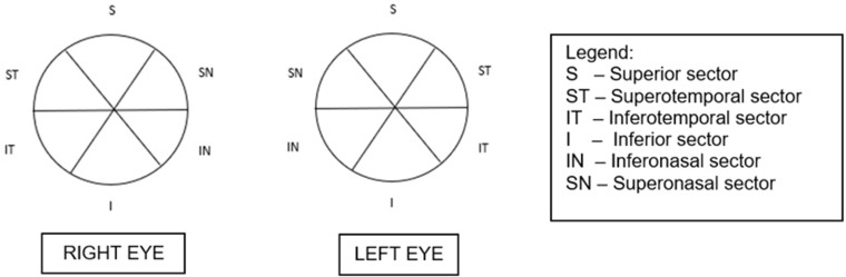 Correlation of Macular Ganglion Cell Layer + Inner Plexiform Layer (GCL + IPL) and Circumpapillary Retinal Nerve Fiber Layer (cRNFL) Thickness in Glaucoma Suspects and Glaucomatous Eyes.