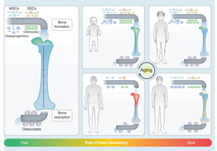 Age-related alveolar bone maladaptation in adult orthodontics: finding new ways out.