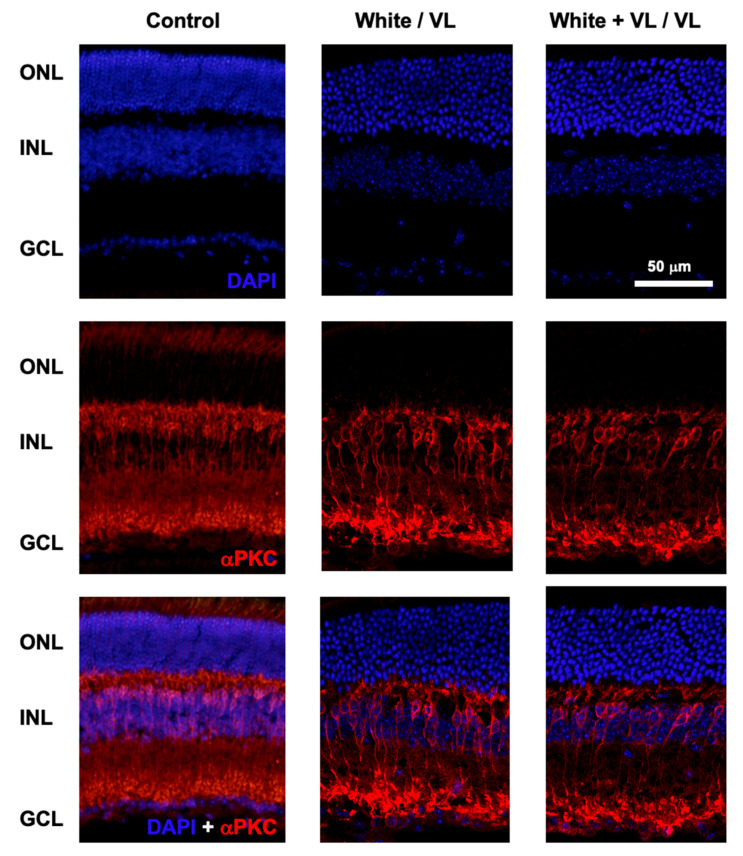 Violet Light Effects on the Circadian Rest-Activity Rhythm and the Visual System.