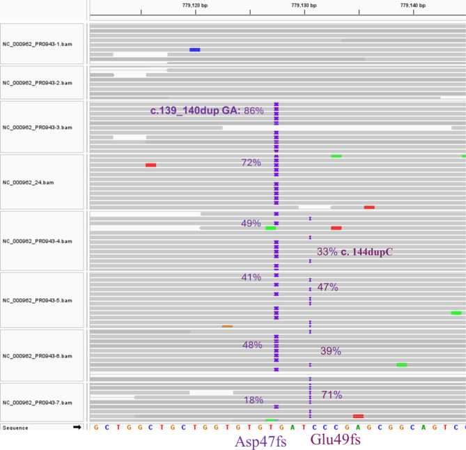 Clinical application of whole-genome sequencing in the management of extensively drug-resistant tuberculosis: a case report.